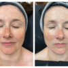 Environ Cool Peels Facial Package Course of 6 with a 7th Facial FREE - Image 2